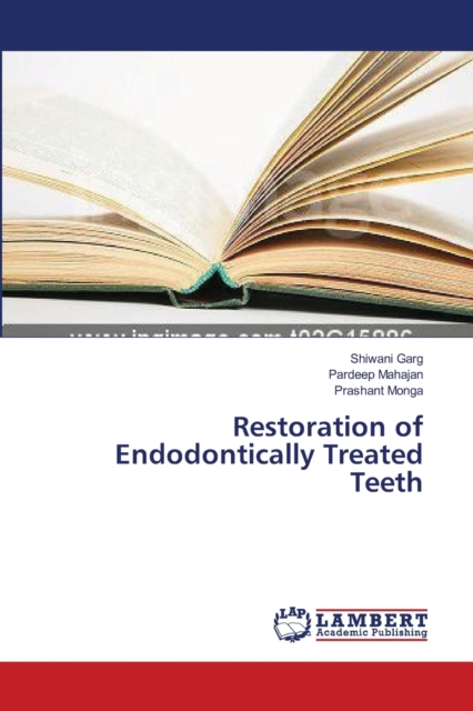 Restoration of Endodontically Treated Teeth, Paperback / softback Book