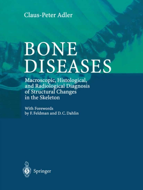 Bone Diseases : Macroscopic, Histological, and Radiological Diagnosis of Structural Changes in the Skeleton, PDF eBook