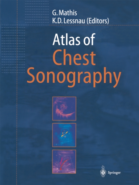 Atlas of Chest Sonography, PDF eBook
