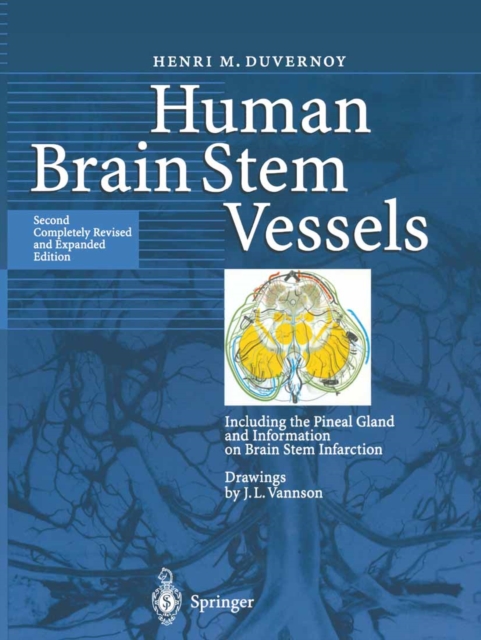 Human Brain Stem Vessels : Including the Pineal Gland and Information on Brain Stem Infarction, PDF eBook