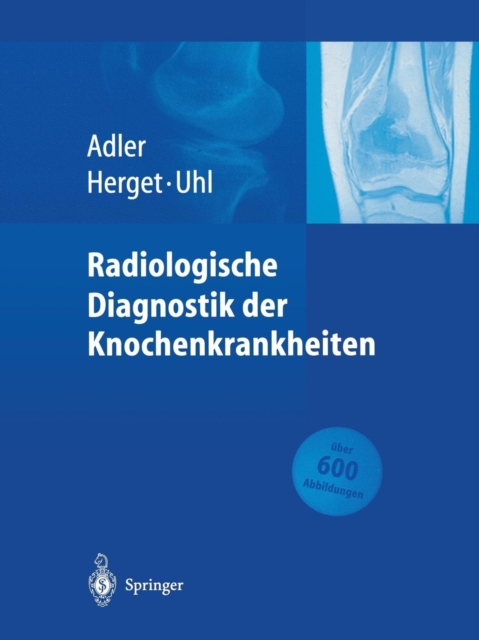 Radiologische Diagnostik der Knochenkrankheiten, Paperback / softback Book
