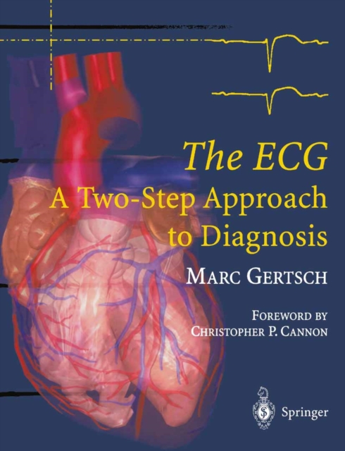 The ECG : A Two-Step Approach to Diagnosis, PDF eBook