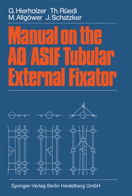 Manual on the AO/ASIF Tubular External Fixator, PDF eBook