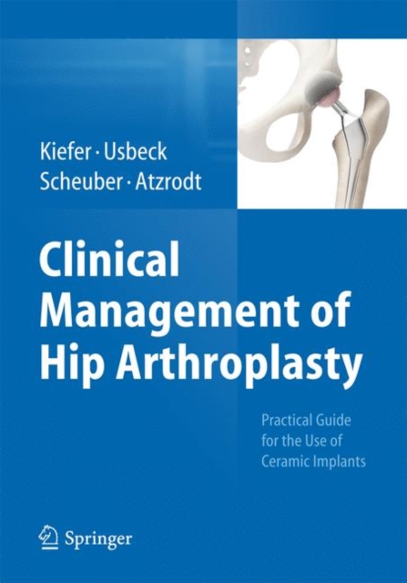 Clinical Management of Hip Arthroplasty : Practical Guide for the Use of Ceramic Implants, Paperback / softback Book