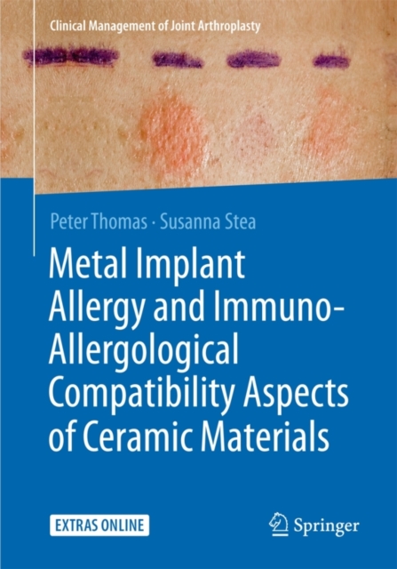 Metal Implant Allergy and Immuno-Allergological Compatibility Aspects of Ceramic Materials, Paperback / softback Book