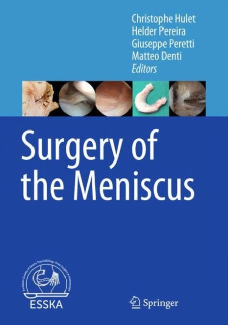 Surgery of the Meniscus, Hardback Book