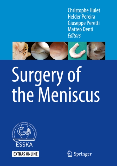 Surgery of the Meniscus, PDF eBook