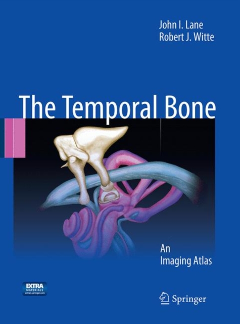 Temporal Bone : An Imaging Atlas, Paperback / softback Book