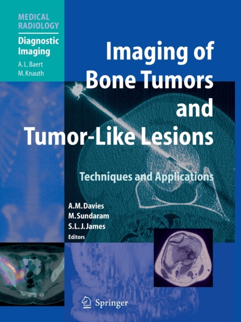 Imaging of Bone Tumors and Tumor-Like Lesions : Techniques and Applications, Paperback / softback Book