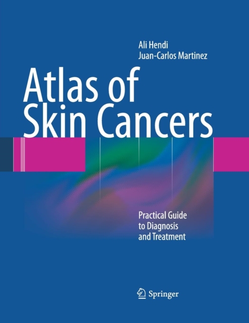 Atlas of Skin Cancers : Practical Guide to Diagnosis and Treatment, Paperback / softback Book