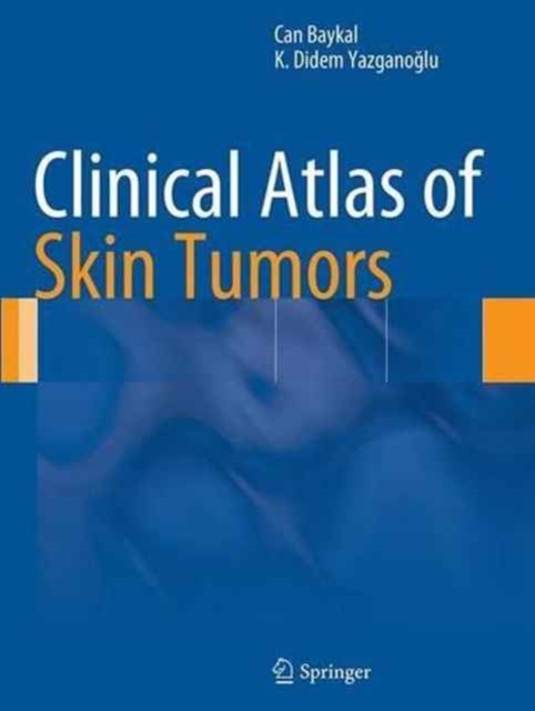 Clinical Atlas of Skin Tumors, Paperback / softback Book