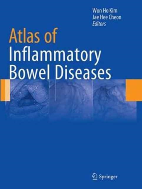 Atlas of Inflammatory Bowel Diseases, Paperback / softback Book