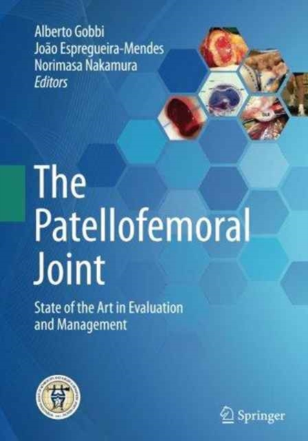The Patellofemoral Joint : State of the Art in Evaluation and Management, Paperback / softback Book
