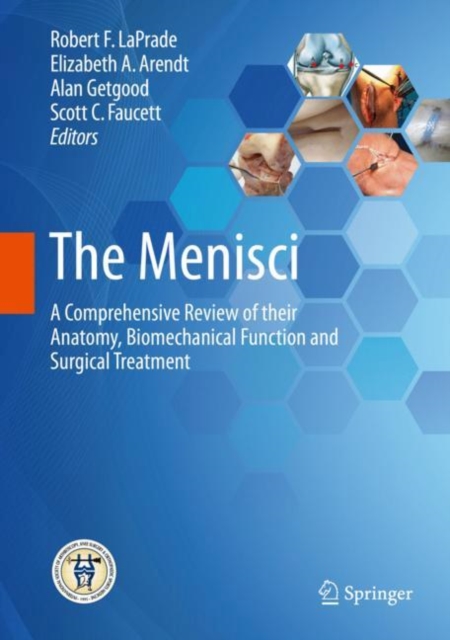 The Menisci : A Comprehensive Review of Their Anatomy, Biomechanical Function and Surgical Treatment, Hardback Book