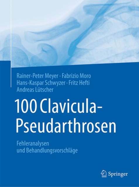 100 Clavicula-Pseudarthrosen : Fehleranalysen und Behandlungsvorschlage, Hardback Book