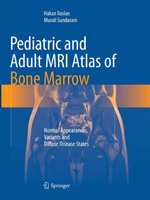 Pediatric and Adult MRI Atlas of Bone Marrow : Normal Appearances, Variants and Diffuse Disease States, Paperback / softback Book