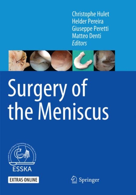 Surgery of the Meniscus, Paperback / softback Book