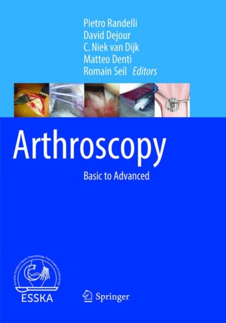 Arthroscopy : Basic to Advanced, Paperback / softback Book