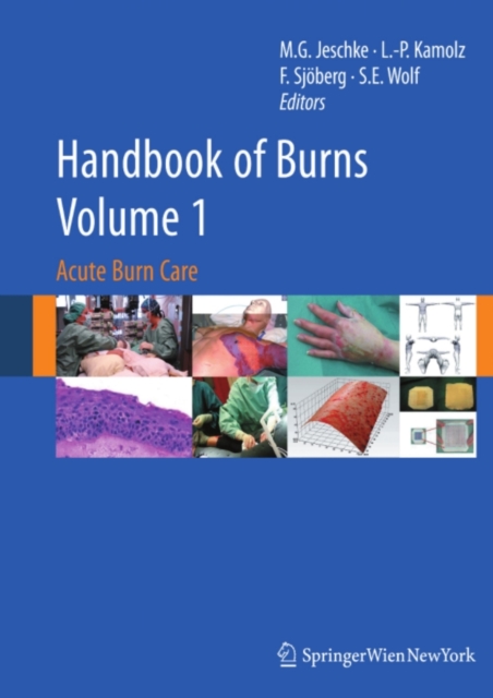 Handbook of Burns Volume 1 : Acute Burn Care, PDF eBook