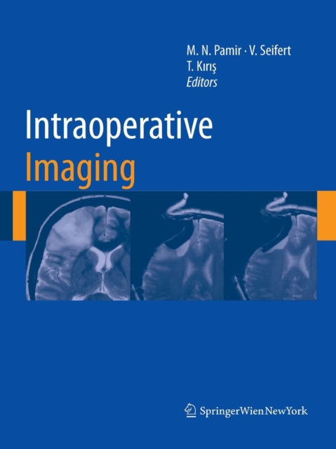 Intraoperative Imaging, Paperback / softback Book