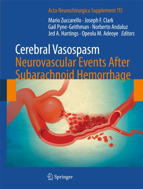 Cerebral Vasospasm: Neurovascular Events After Subarachnoid Hemorrhage, Hardback Book