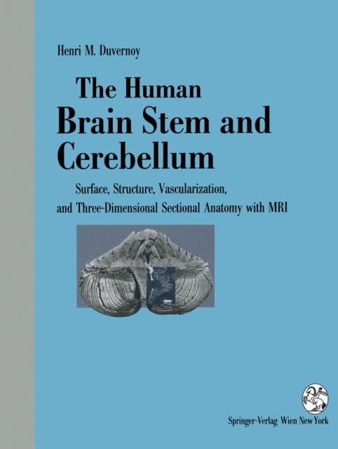 The Human Brain Stem and Cerebellum : Surface, Structure, Vascularization, and Three-Dimensional Sectional Anatomy, with MRI, PDF eBook