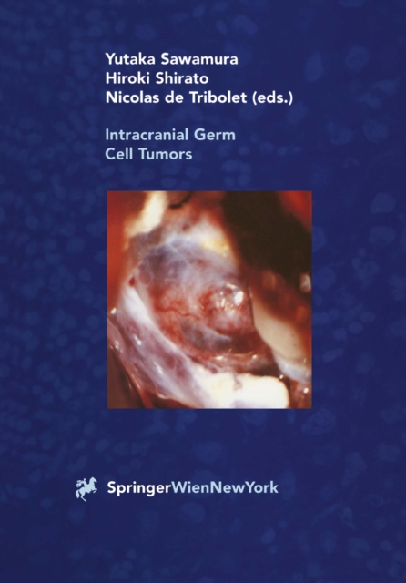 Intracranial Germ Cell Tumors, PDF eBook