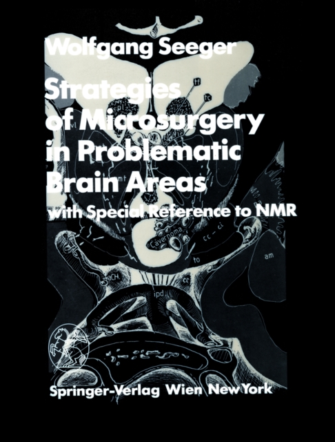 Strategies of Microsurgery in Problematic Brain Areas : with Special Reference to NMR, PDF eBook