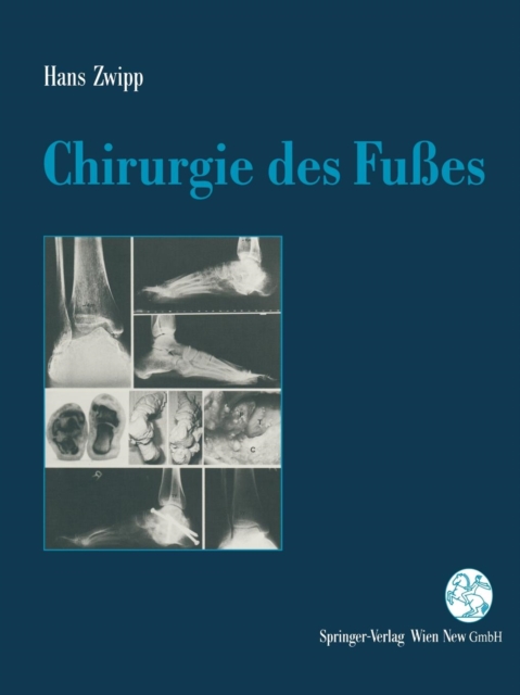Chirurgie Des Fusses, Paperback / softback Book