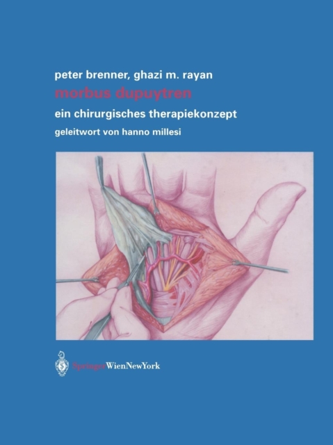 Morbus Dupuytren : Ein Chirurgisches Therapiekonzept, Paperback / softback Book
