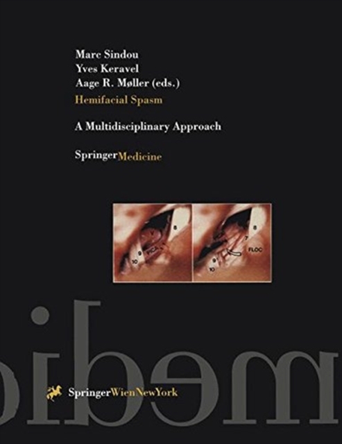 Hemifacial Spasm : A Multidisciplinary Approach, Paperback / softback Book