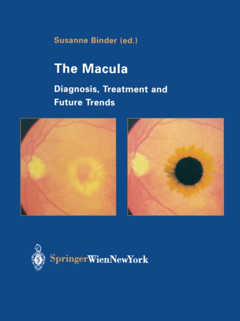 The Macula : Diagnosis, Treatment and Future Trends, PDF eBook