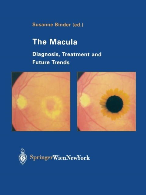 The Macula : Diagnosis, Treatment and Future Trends, Paperback / softback Book