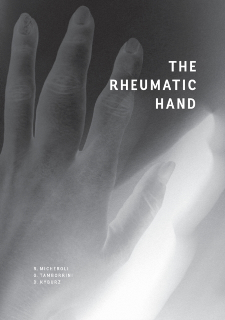 The Rheumatic Hand, Paperback / softback Book