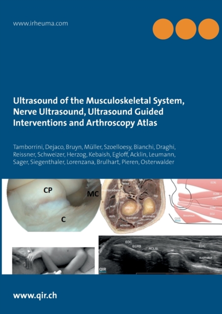 Ultrasound of the Musculoskeletal System, Nerve Ultrasound, Ultrasound Guided Interventions and Arthroscopy Atlas : Musculoskeletal Sonoanatomy Guidelines, Paperback / softback Book