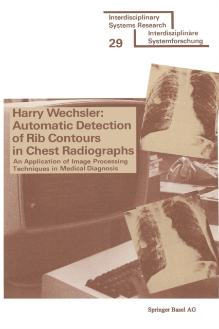Automatic Detection of Rib Contours in Chest Radiographs : An Application of Image Processing Techniques in Medical Diagnosis, Paperback / softback Book