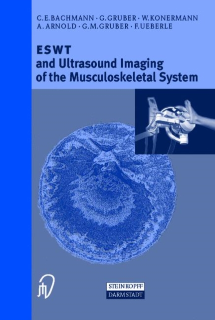 ESWT and Ultrasound Imaging of the Musculoskeletal System, Paperback / softback Book
