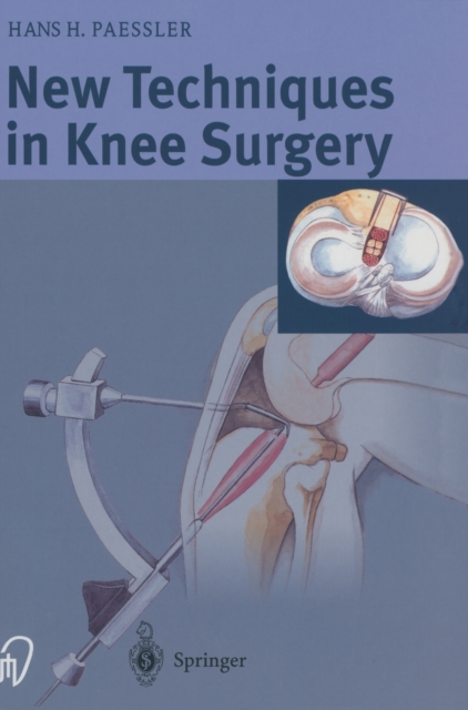 New Techniques in Knee Surgery, Hardback Book