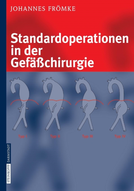 Standardoperationen in der Gefasschirurgie, Book Book