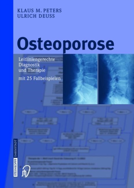Osteoporose : Leitliniengerechte Diagnostik Und Therapie MIT 25 Fallbeispielen, Book Book