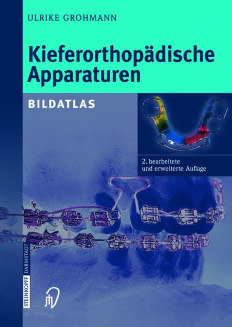 Kieferorthopadische Apparaturen : Bildatlas, Book Book