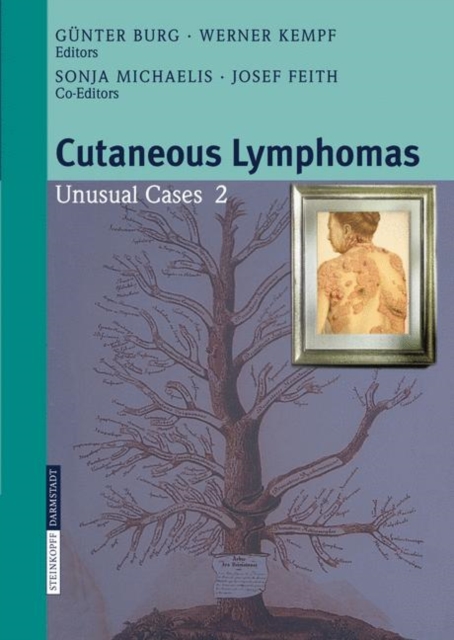 Cutaneous Lymphomas : Unusual Cases 2, Hardback Book