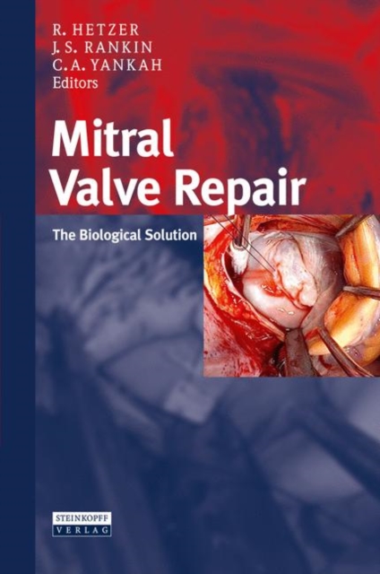 Mitral Valve Repair : The Biological Solution, Hardback Book