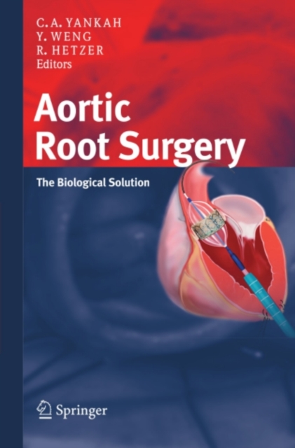 Aortic Root Surgery : The Biological Solution, PDF eBook