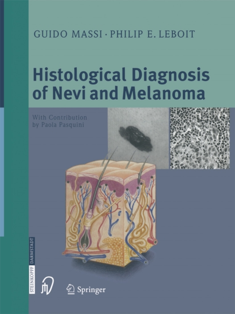 Histological Diagnosis of Nevi and Melanoma, PDF eBook