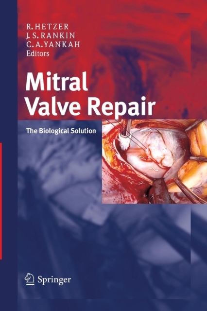 Mitral Valve Repair : The Biological Solution, Paperback / softback Book