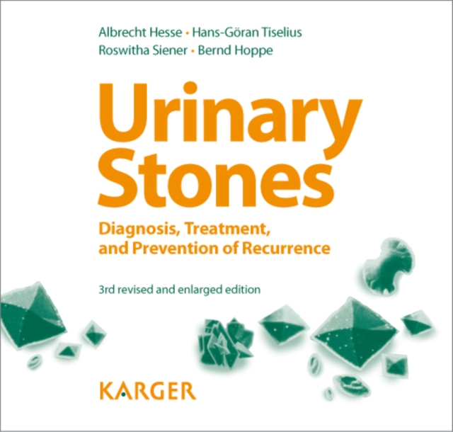 Urinary Stones : Diagnosis, Treatment, and Prevention of Recurrence Foreword by H.E. Williams (Davis, Calif.)., PDF eBook