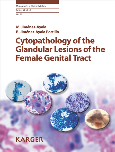 Cytopathology of the Glandular Lesions of the Female Genital Tract, PDF eBook