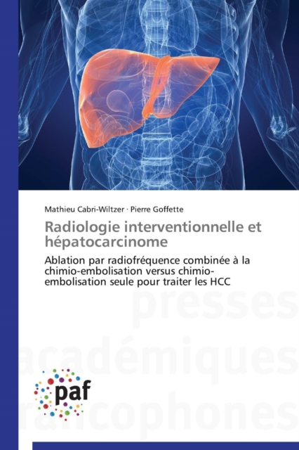Radiologie Interventionnelle Et Hepatocarcinome, Paperback / softback Book