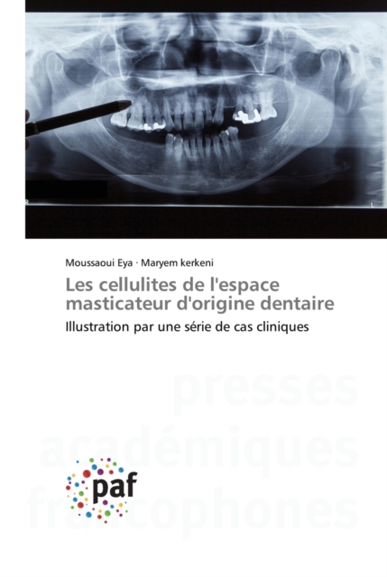 Les cellulites de l'espace masticateur d'origine dentaire, Paperback / softback Book